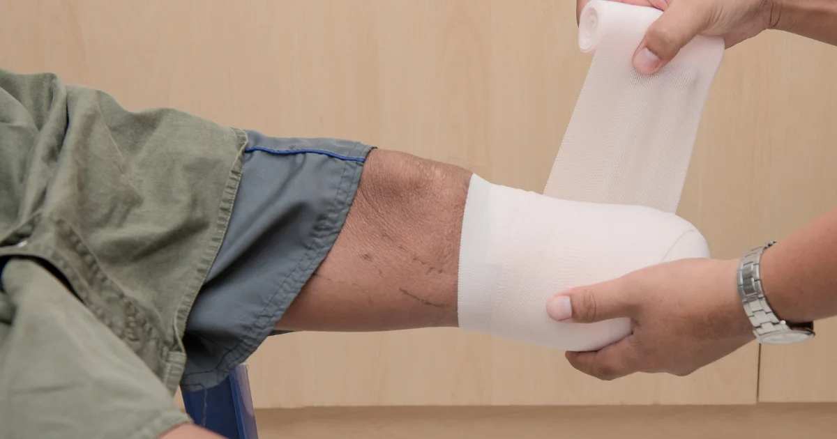 kencing-manis-potong-kaki