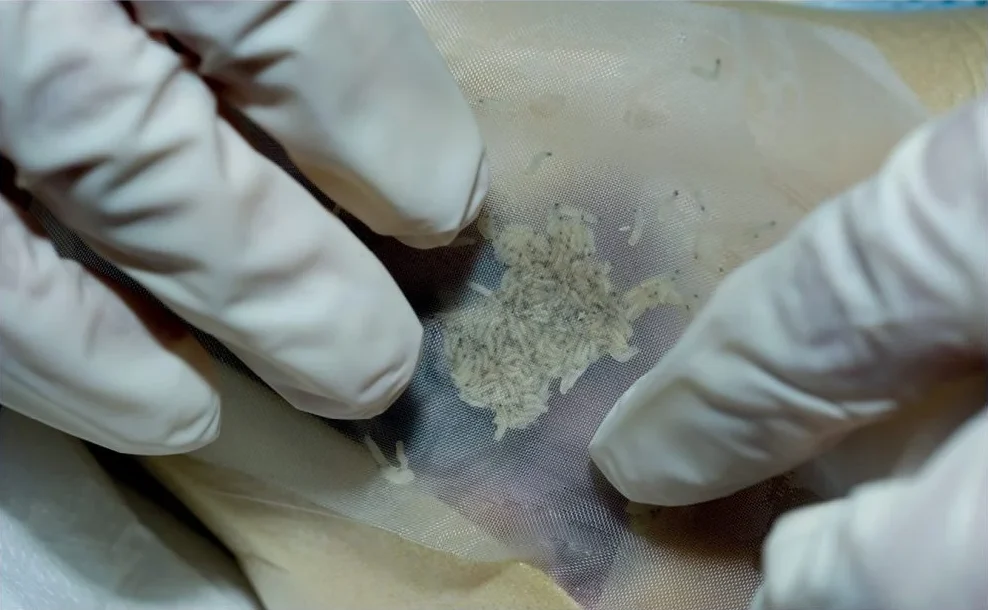 klinik-cuci-luka-maggot-therapy