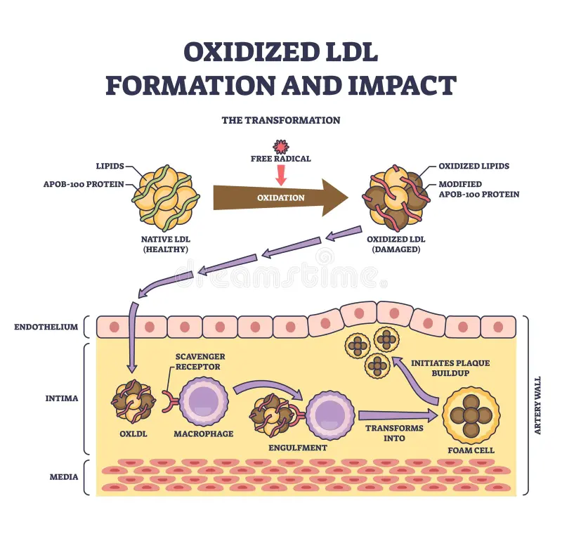 tanda-kolestrol-tinggi-xanthelasma